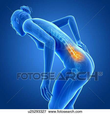 Stock Illustration - Human back pain, illustration. Fotosearch