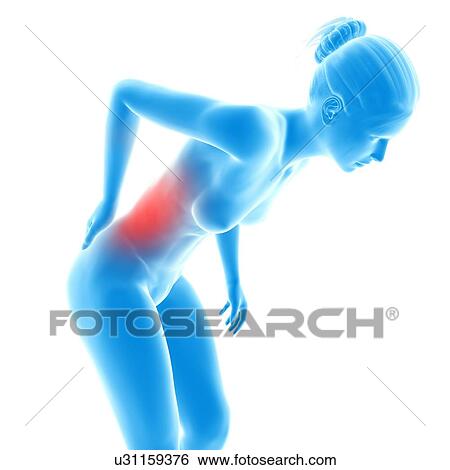 Human back pain, illustration View Large Illustration Stock Illustration - Human back pain, illustration. Fotosearch