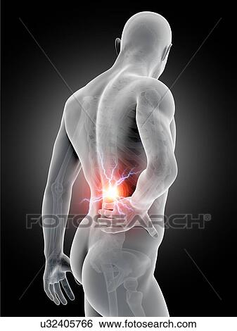 Stock Illustration - Human back pain, illustration. Fotosearch