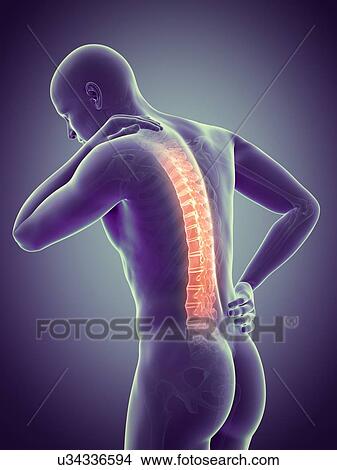 Stock Illustration - Human back pain, illustration. Fotosearch