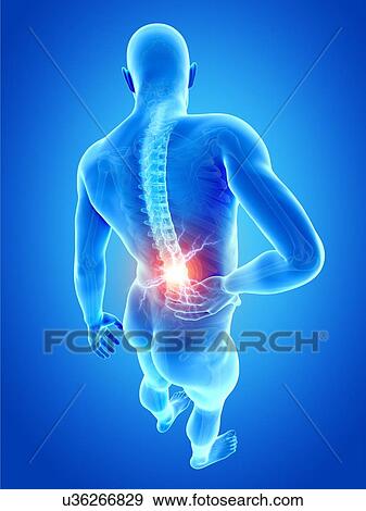 Human back pain, illustration View Large Illustration Stock Illustration - Human back pain, illustration. Fotosearch