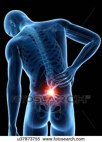 Stock Illustration - Human back pain, illustration. Fotosearch