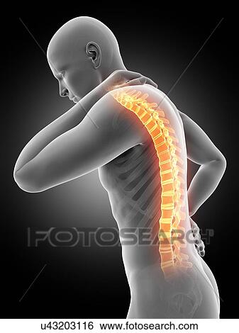 Human back pain, illustration View Large Illustration Stock Illustration - Human back pain, illustration. Fotosearch
