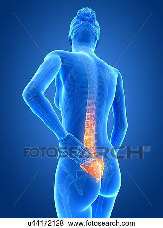 Stock Illustration - Human back pain, illustration. Fotosearch