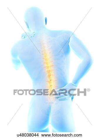 Stock Illustration - Human back pain, illustration. Fotosearch