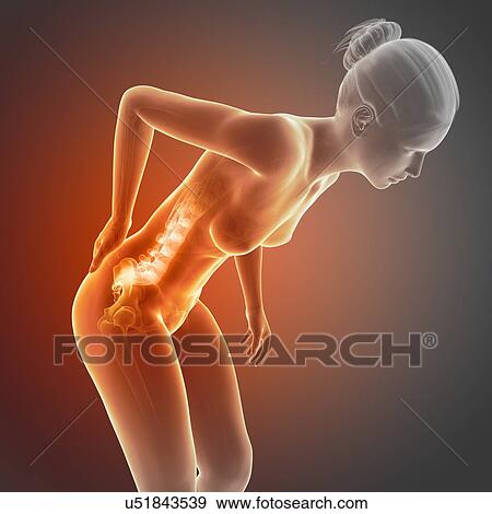 Stock Illustration - Human back pain, illustration. Fotosearch