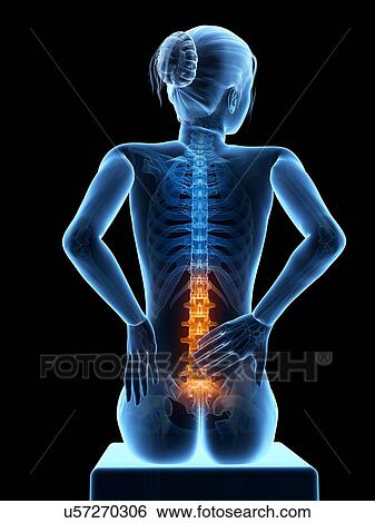 Human back pain, illustration View Large Illustration Stock Illustration - Human back pain, illustration. Fotosearch