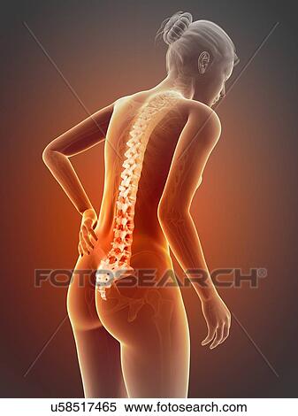 Stock Illustration - Human back pain, illustration. Fotosearch