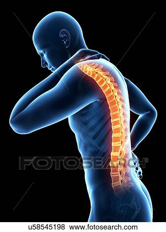 Stock Illustration - Human back pain, illustration. Fotosearch