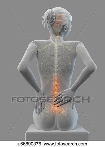 Stock Illustration - Human back pain, illustration. Fotosearch