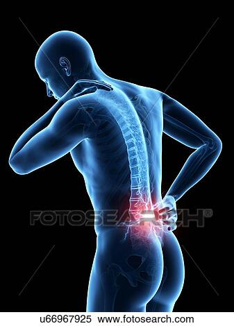 Human back pain, illustration View Large Illustration Stock Illustration - Human back pain, illustration. Fotosearch