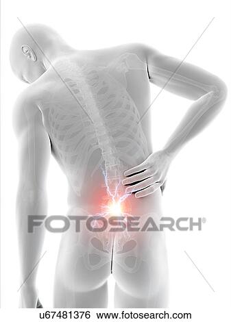 Human back pain, illustration View Large Illustration Stock Illustration - Human back pain, illustration. Fotosearch