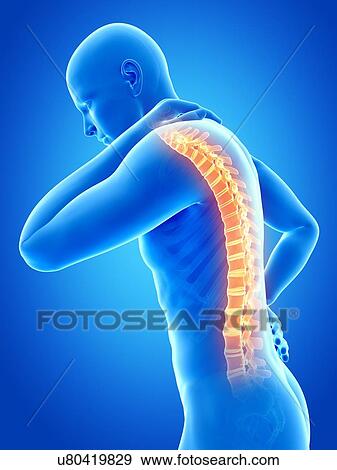 Human back pain, illustration View Large Illustration Stock Illustration - Human back pain, illustration. Fotosearch