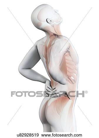 Stock Illustration - Human back pain, illustration. Fotosearch