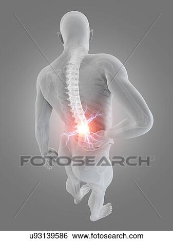 Stock Illustration - Human back pain, illustration. Fotosearch