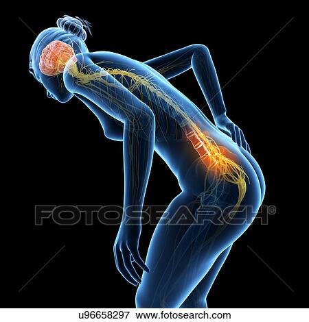 Stock Illustration - Human back pain, illustration. Fotosearch