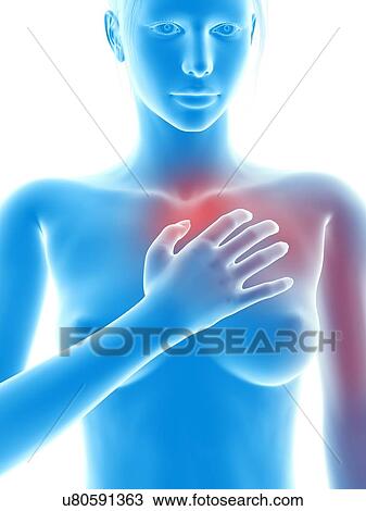 Human chest pain, illustration View Large Illustration Drawing - Human chest pain, illustration. Fotosearch