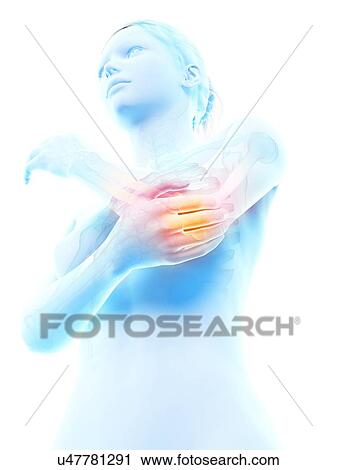 Human elbow joint pain, illustration View Large Illustration Clip Art - Human elbow joint pain, illustration. Fotosearch