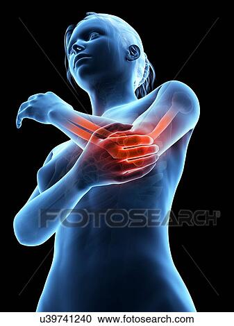 Human elbow joint pain, illustration View Large Illustration Clipart - Human elbow joint pain, illustration. Fotosearch