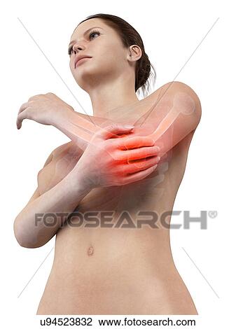 Human elbow joint pain, illustration View Large Illustration Drawing - Human elbow joint pain, illustration. Fotosearch
