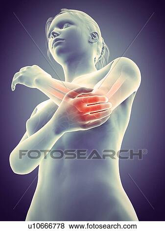 Human elbow joint pain, illustration View Large Illustration Stock Illustration - Human elbow joint pain, illustration. Fotosearch
