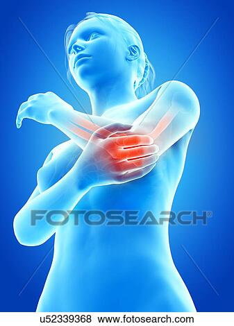 Stock Illustration - Human elbow joint pain, illustration. Fotosearch