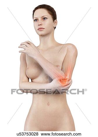 Stock Illustration - Human elbow joint pain, illustration. Fotosearch