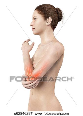 Human elbow joint pain, illustration View Large Illustration Stock Illustration - Human elbow joint pain, illustration. Fotosearch