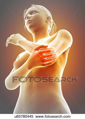 Human elbow joint pain, illustration View Large Illustration Stock Illustration - Human elbow joint pain, illustration. Fotosearch