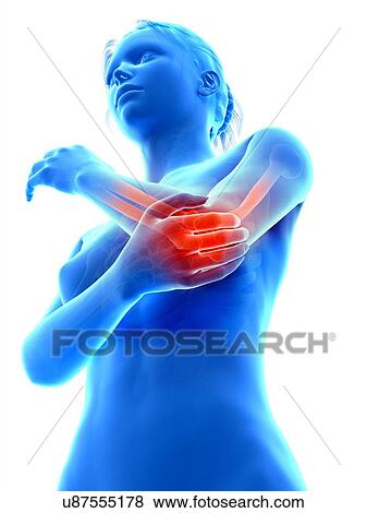 Human elbow joint pain, illustration View Large Illustration Stock Illustration - Human elbow joint pain, illustration. Fotosearch