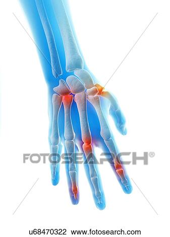 Human hand joints, illustration View Large Illustration Drawing - Human hand joints, illustration. Fotosearch