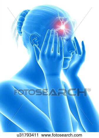 Human headache, illustration View Large Illustration Clip Art - Human headache, illustration. Fotosearch