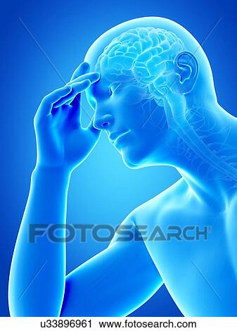 Human headache, illustration View Large Illustration Clip Art - Human headache, illustration. Fotosearch