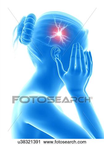 Clip Art - Human headache, illustration. Fotosearch