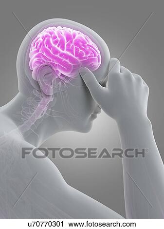 Clip Art - Human headache, illustration. Fotosearch
