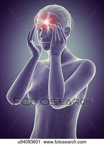 Clip Art - Human headache, illustration. Fotosearch