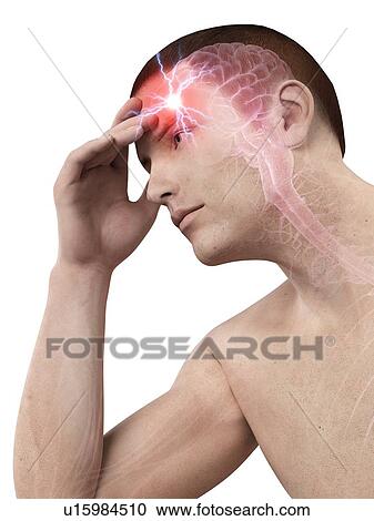 Human headache, illustration View Large Illustration Clipart - Human headache, illustration. Fotosearch