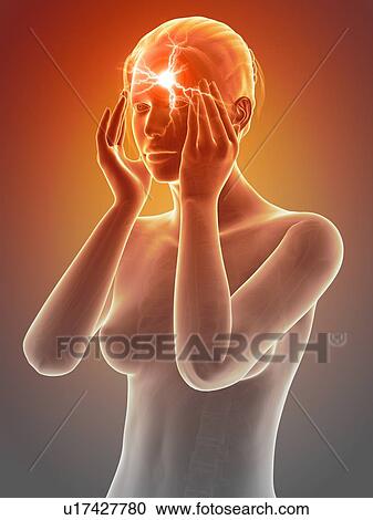 Clipart - Human headache, illustration. Fotosearch