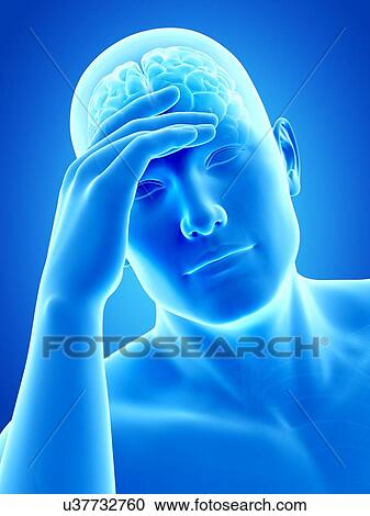 Clipart - Human headache, illustration. Fotosearch