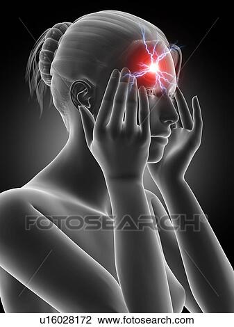 Drawing - Human headache, illustration. Fotosearch