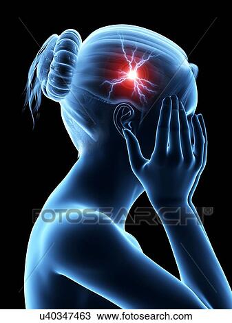 Drawing - Human headache, illustration. Fotosearch