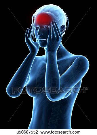 Human headache, illustration View Large Illustration Drawing - Human headache, illustration. Fotosearch