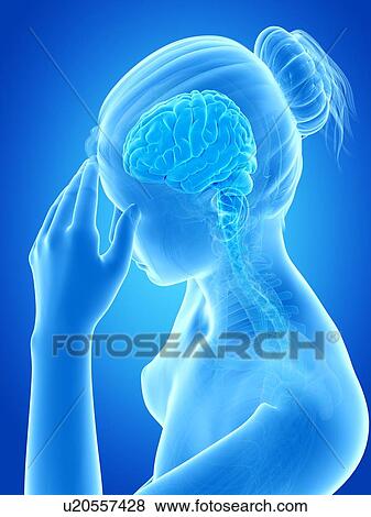 Human headache, illustration View Large Illustration Stock Illustration - Human headache, illustration. Fotosearch