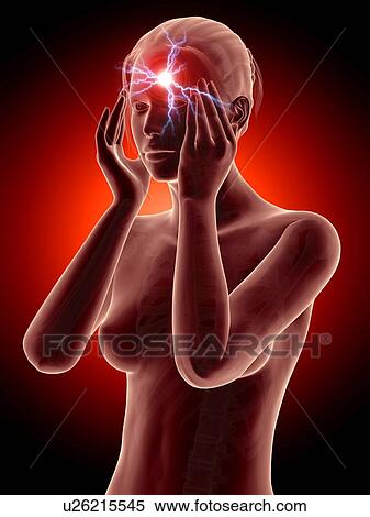 Stock Illustration - Human headache, illustration. Fotosearch