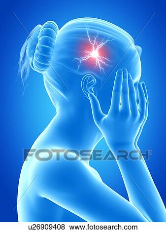 Stock Illustration - Human headache, illustration. Fotosearch