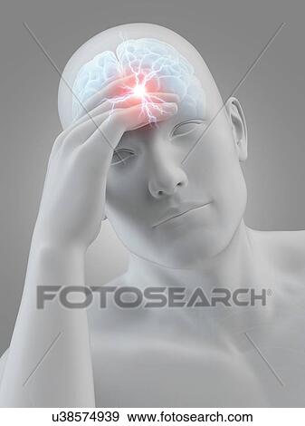 Stock Illustration - Human headache, illustration. Fotosearch