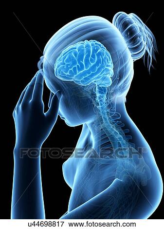 Stock Illustration - Human headache, illustration. Fotosearch