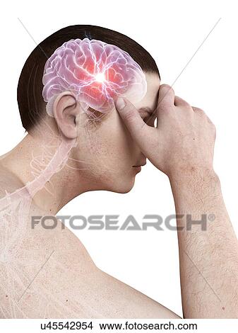 Stock Illustration - Human headache, illustration. Fotosearch