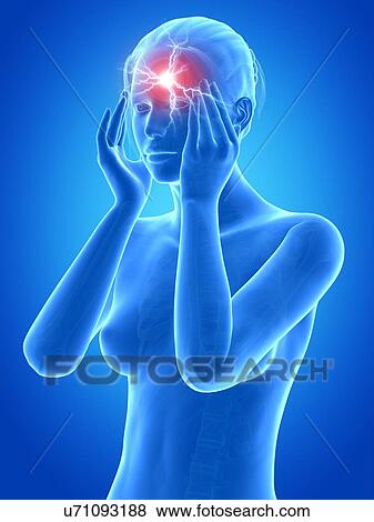 Stock Illustration - Human headache, illustration. Fotosearch