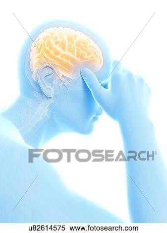 Stock Illustration - Human headache, illustration. Fotosearch